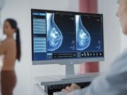 La SECA, la Fundació ECO i Novartis impulsen un model integrat per al càncer de mama precoç